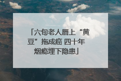 六旬老人唇上“黄豆”拖成癌 四十年烟瘾埋下隐患