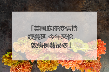 英国麻疹疫情持续蔓延 今年来伦敦病例数最多