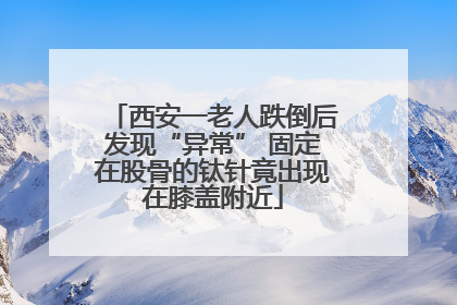 西安一老人跌倒后发现“异常” 固定在股骨的钛针竟出现在膝盖附近